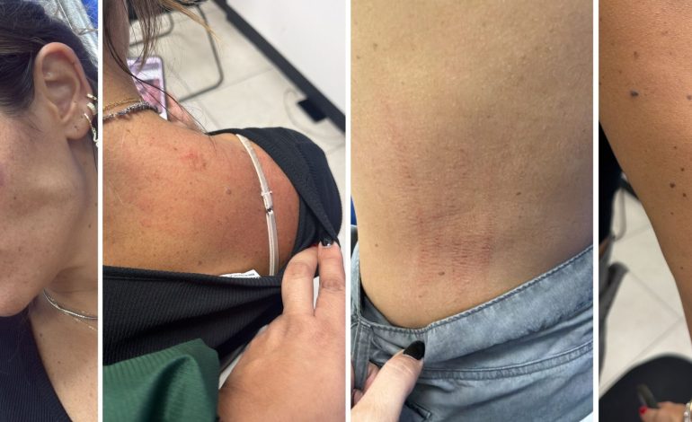 Colaboradores de Ale Rojo presentan lesiones delicadas