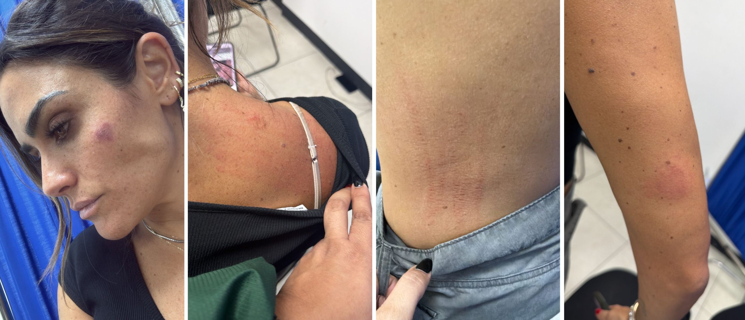 Colaboradores de Ale Rojo presentan lesiones delicadas